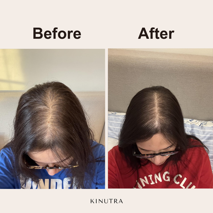 Kinutra Pumpkin Seed Oil with Saw Palmetto - 300 Capsules